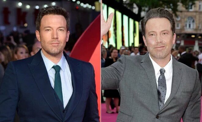 Ben Affleck Operación Estética