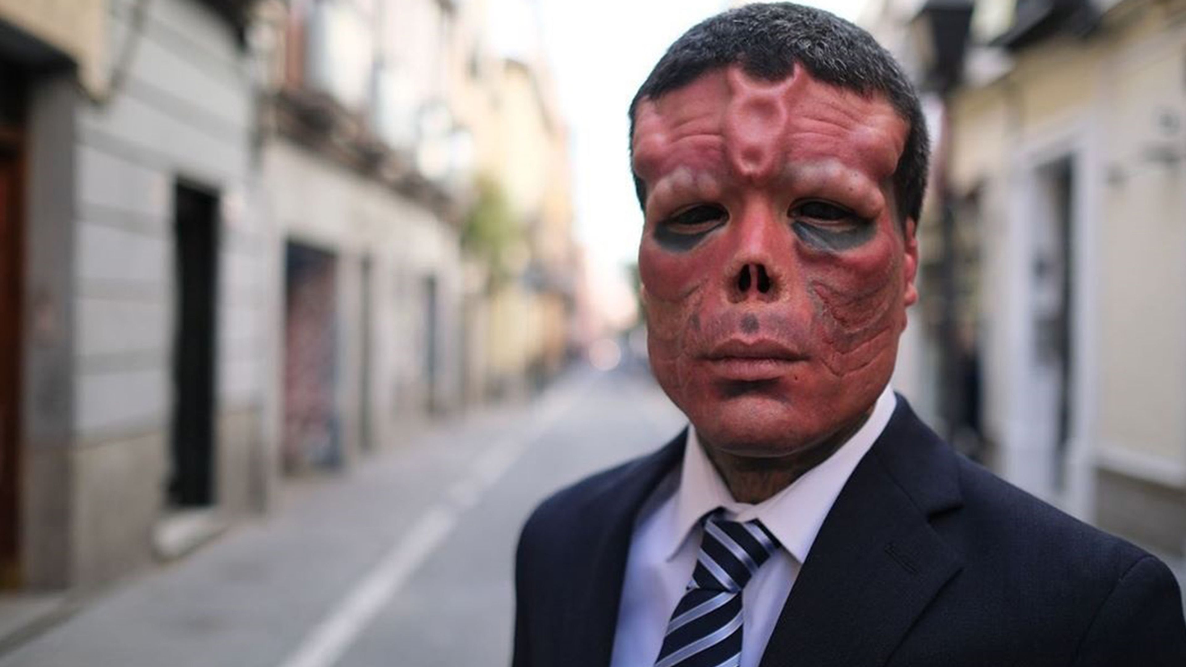 Cráneo Rojo de Galicia